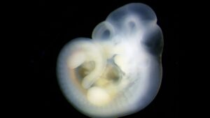E10p5 mouse embryo